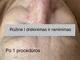 Editos Bubienės veido ir kūno procedūros