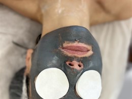 OdosEkspertas.lt pas Nataliją