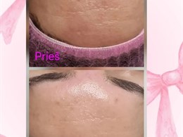 Aparatinė kosmetologija ir veido masažai – kosmetologė Kristina