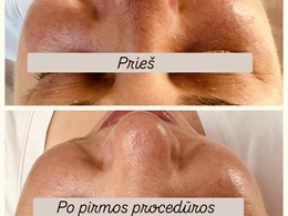 Veido ir kūno procedūros | Edita Bubinienė