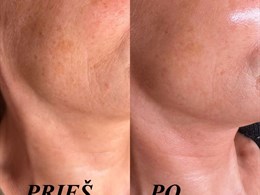 Estetinė kosmetologija - specialistė Goda