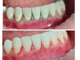 Velvet smile care