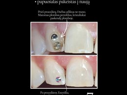Adri7 šypsenos klinika