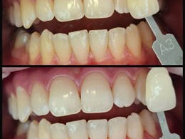 Velvet smile care