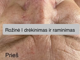 Editos Bubienės veido ir kūno procedūros