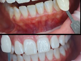 Velvet smile care