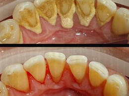 Velvet smile care