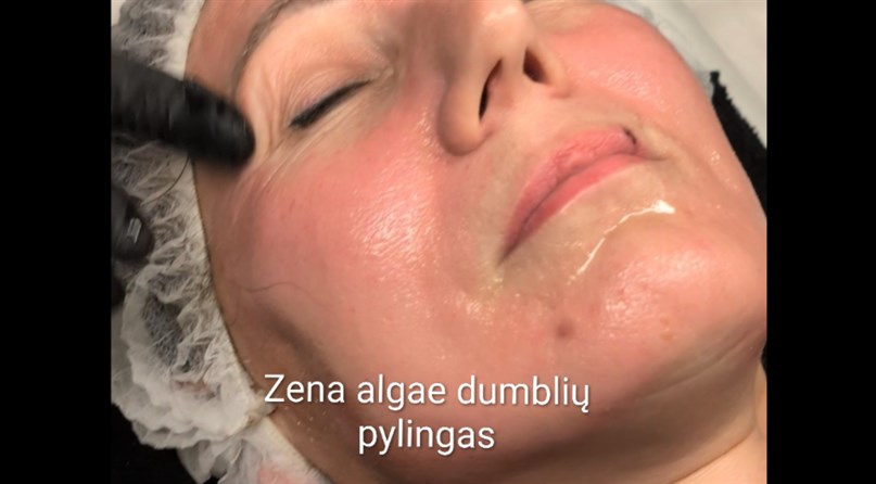 Grožio paslaptys - kosmetologė masažistė Berta