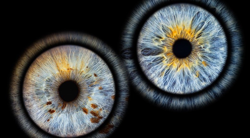 Eye2Eye Kaunas