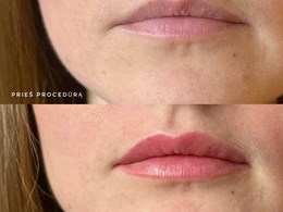 Kristina Nalevaikienė (Perla muter)