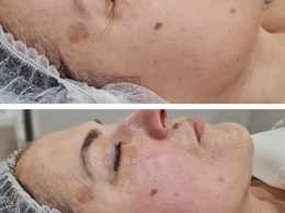 Iveta.Skin&beauty 