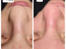 Aparatinė kosmetologija ir veido masažai – kosmetologė Kristina