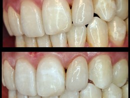 Velvet smile care