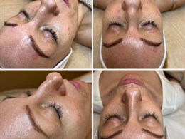 Jurgita: grožio terapija