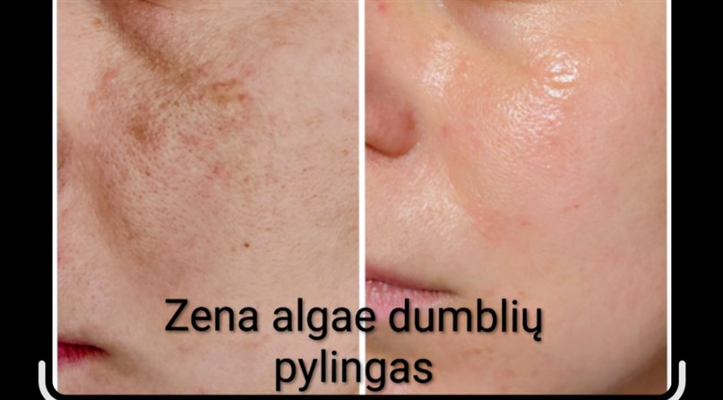 Grožio paslaptys - kosmetologė masažistė Berta