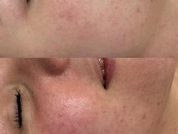 Be You Beauty salonas