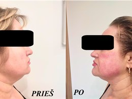 Estetinė kosmetologija - specialistė Goda