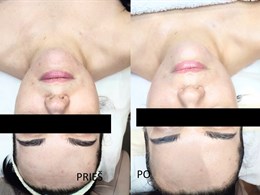 Estetinė kosmetologija - specialistė Goda