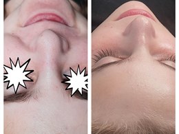 Skin by Vaida grožio estetikė-masažuotoja